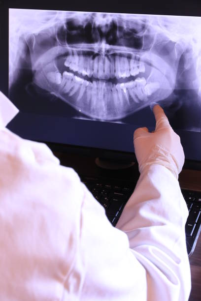 Best Emergency Wisdom Teeth Removal in Ruidoso, NM